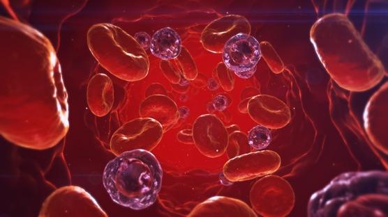 Kanda Enfeksiyon: Belirtileri, Nedenleri, Tedavisi, Riskleri ve Daha Fazlası