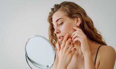 İnatçı Sivilcelerin 10 Nedeni