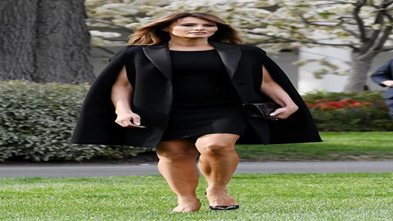 MELANIA TRUMPIN SAĞLIK SORUNU